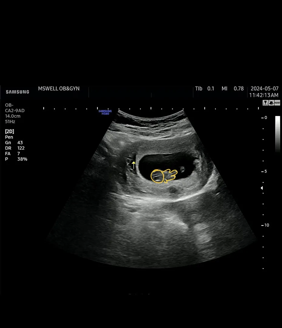 9주차 하리보 보고왔어용 👶🏻🤍