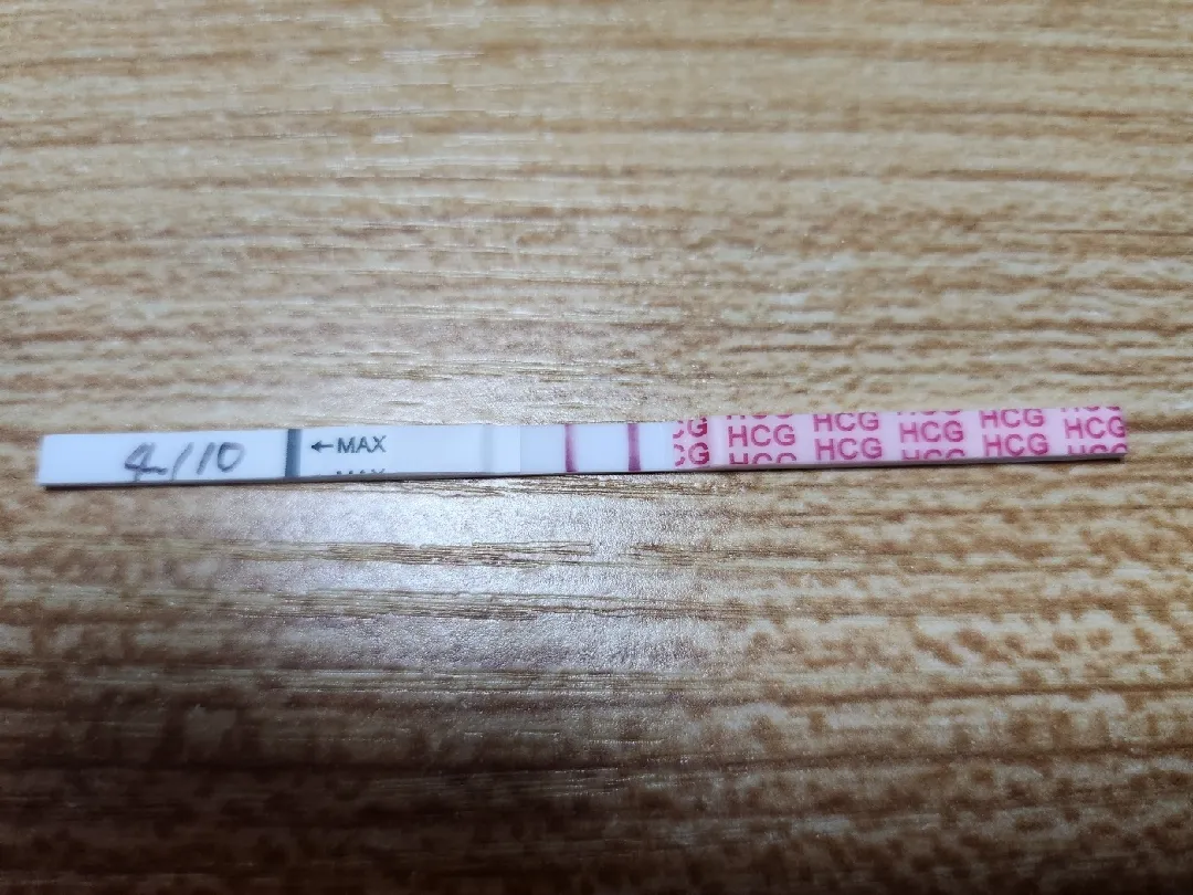 아기집 볼수있을까요?