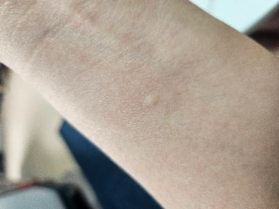 어디 병원에 가야할까요?