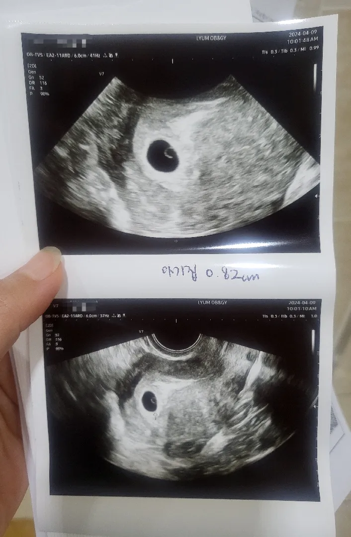 임신확인서는 받으셨나요?