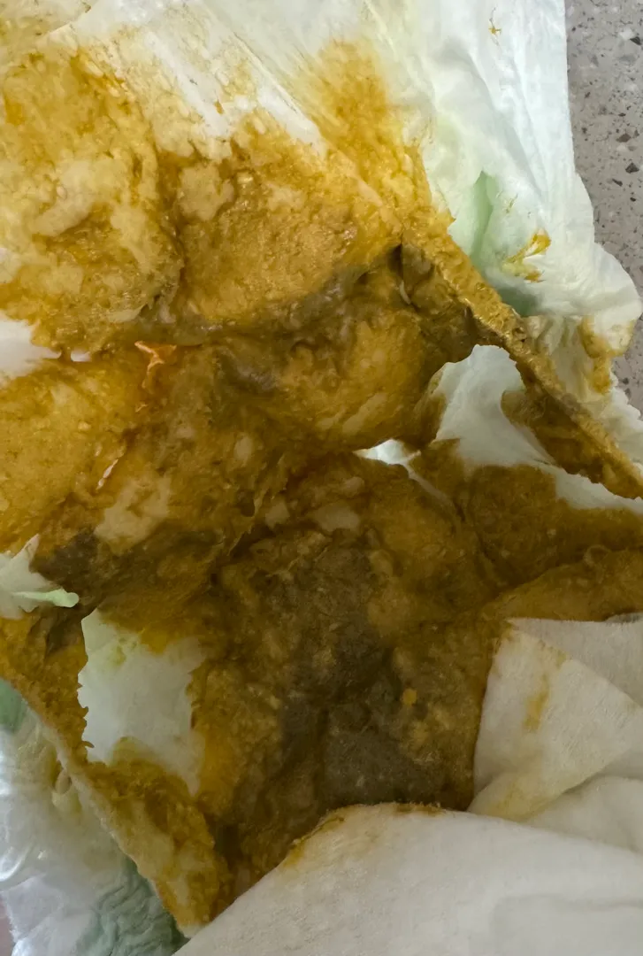 51일차 아가변상태 확인부탁드려요(사진주의)
