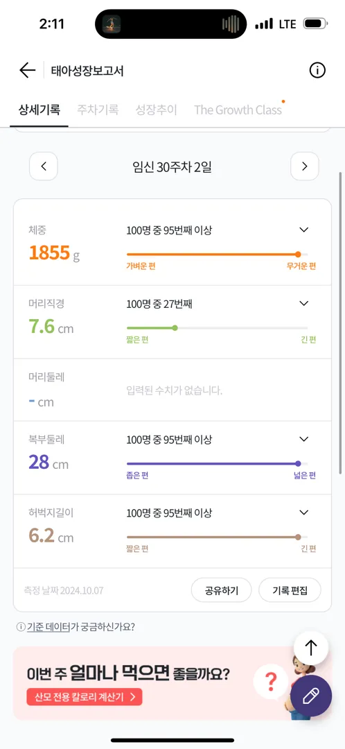 오늘 병원다녀왔는데 애가.. 넘 커요 ㅠㅠㅠ