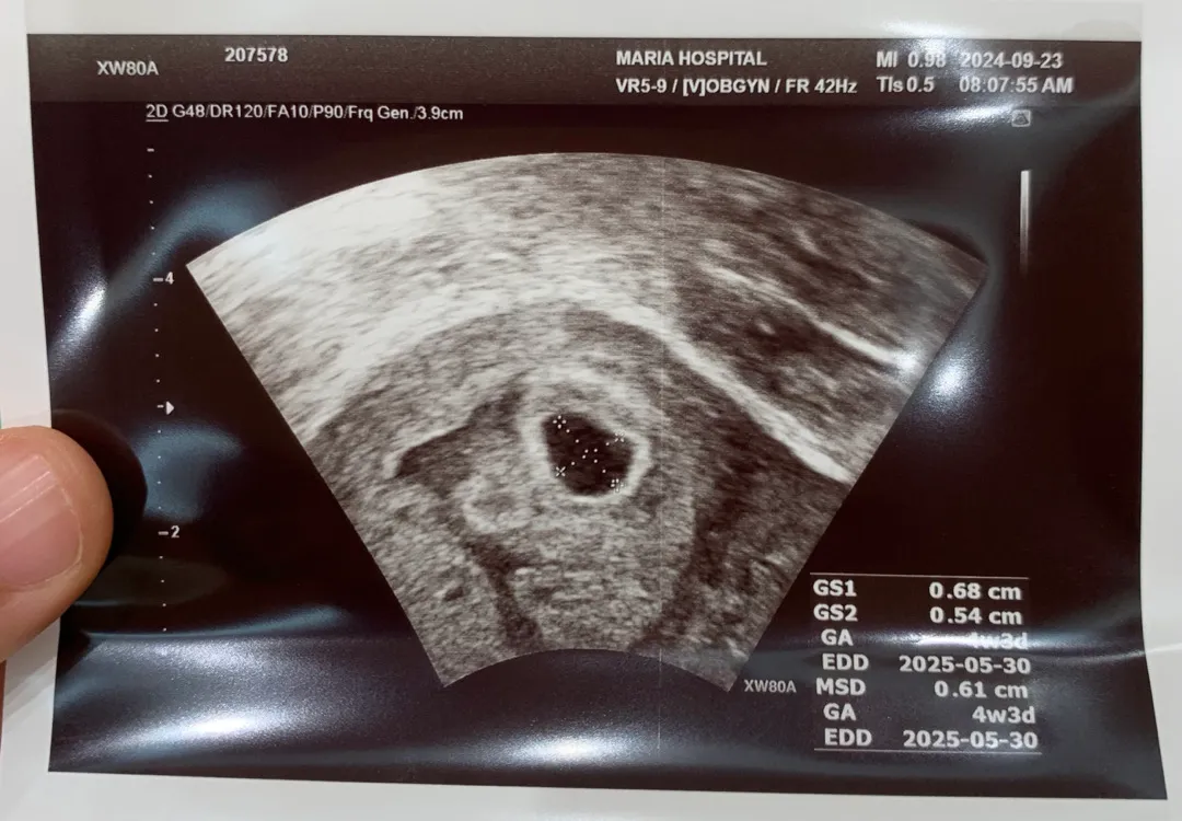 아기집 보고왔어요 4w6d