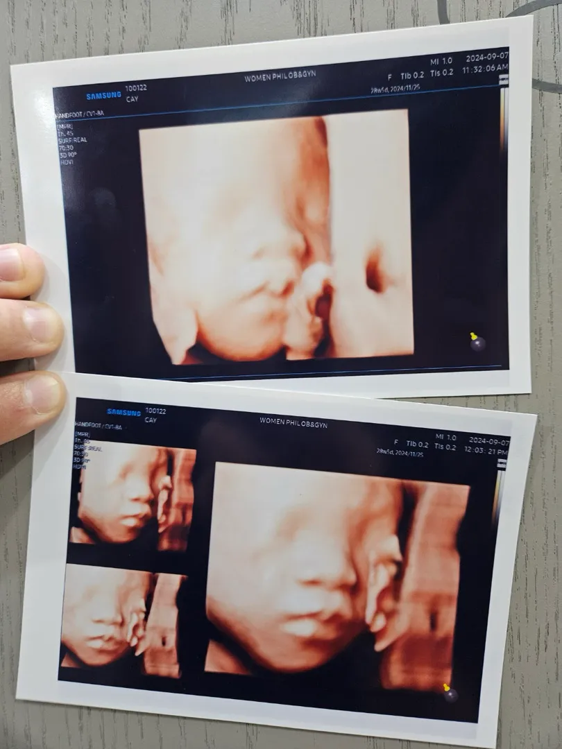 29주 3일