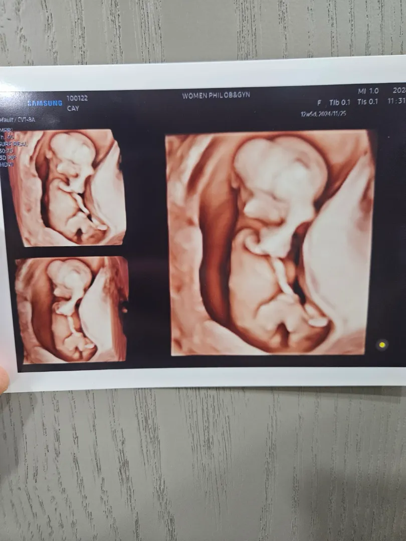 특수 초음파