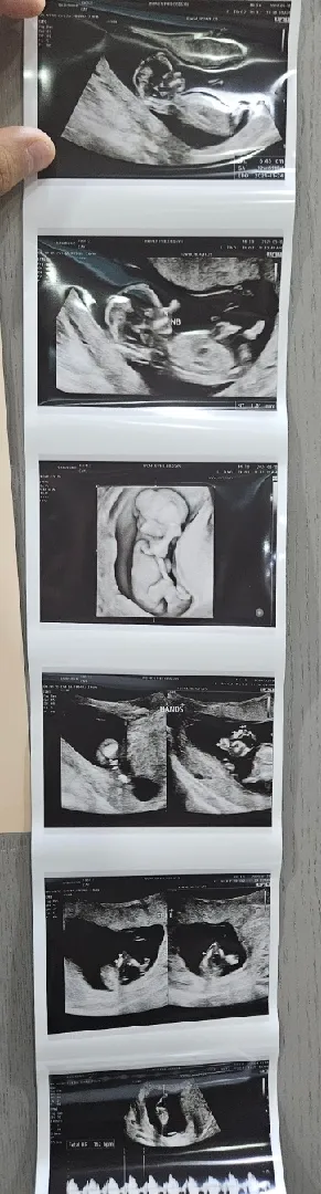12주5일 행복이 보여왔어요