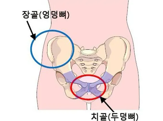 18주 치골통