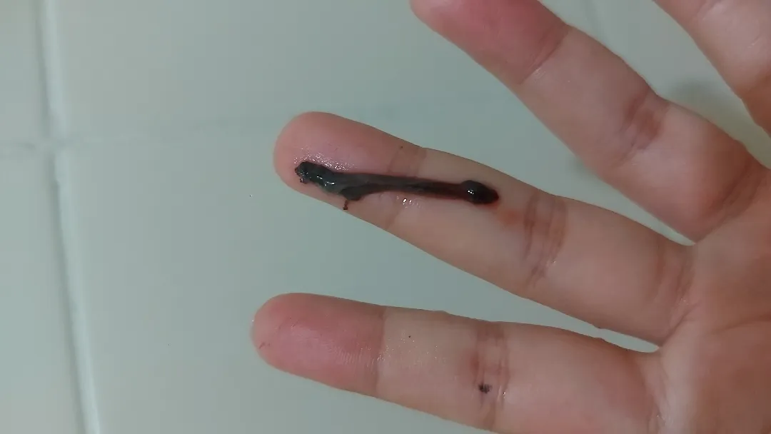 Keluar Lendir Hitam