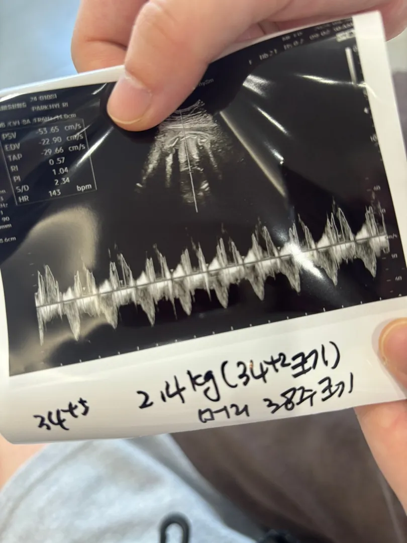 왕 머리 우리 아기