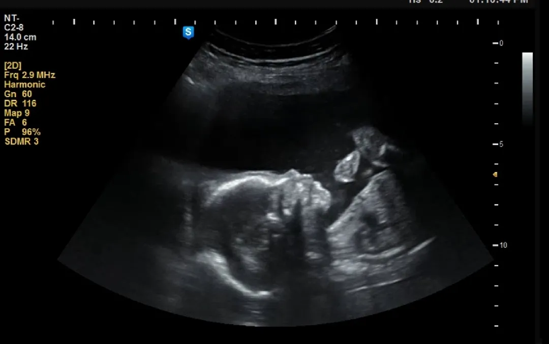 20w4d 오늘정밀촘파 아니었네용ㅠㅠ