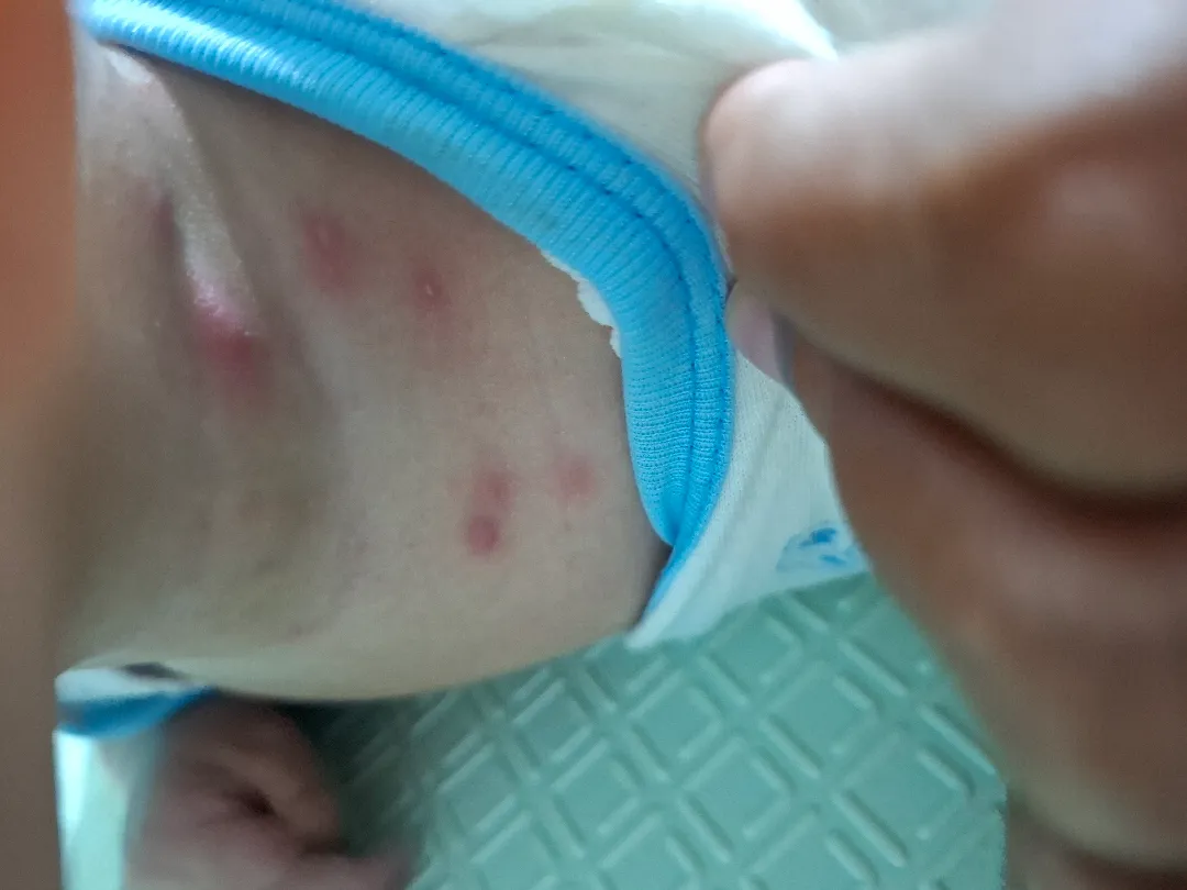 Bun ada yang pernah begini baby nya?