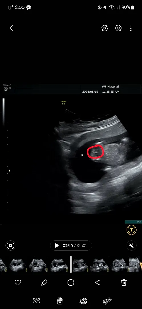 혹시 이게 아들인가요?
