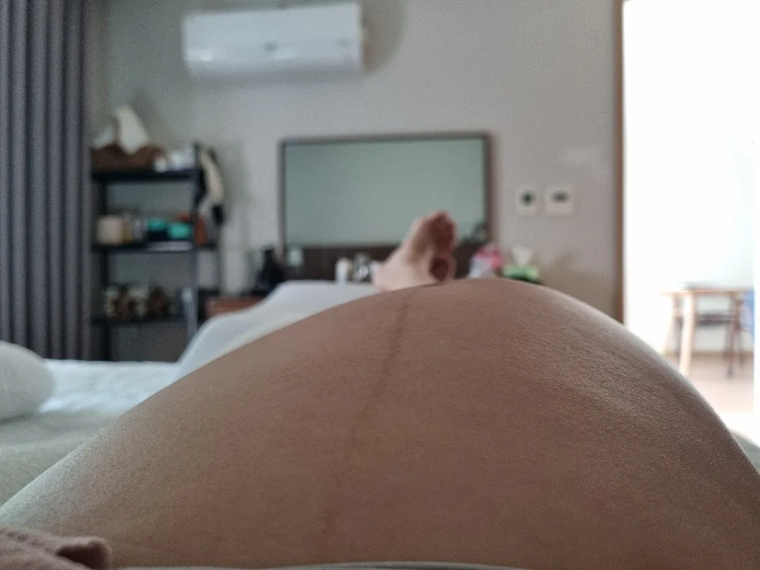 배뭉침 배모양