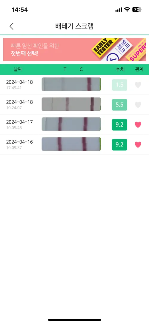 임테기 언제해봐야될까요? 가능성은 있을까요?