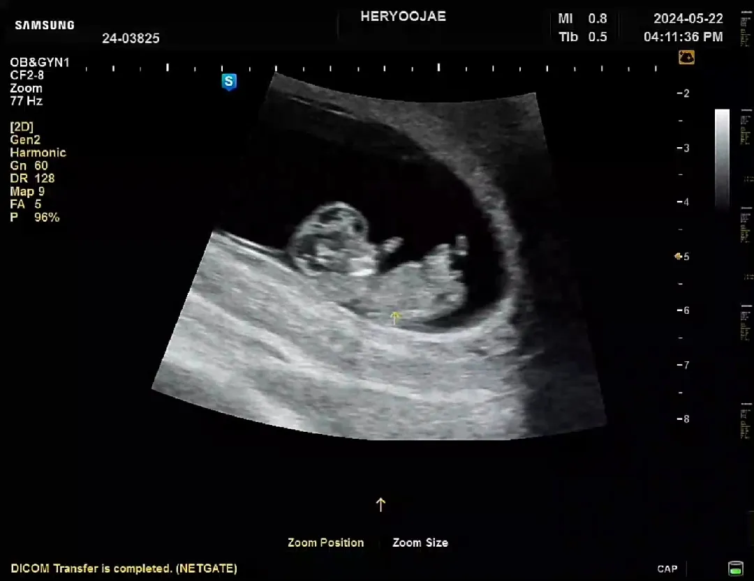 10주에도 각도법 가능할까요??