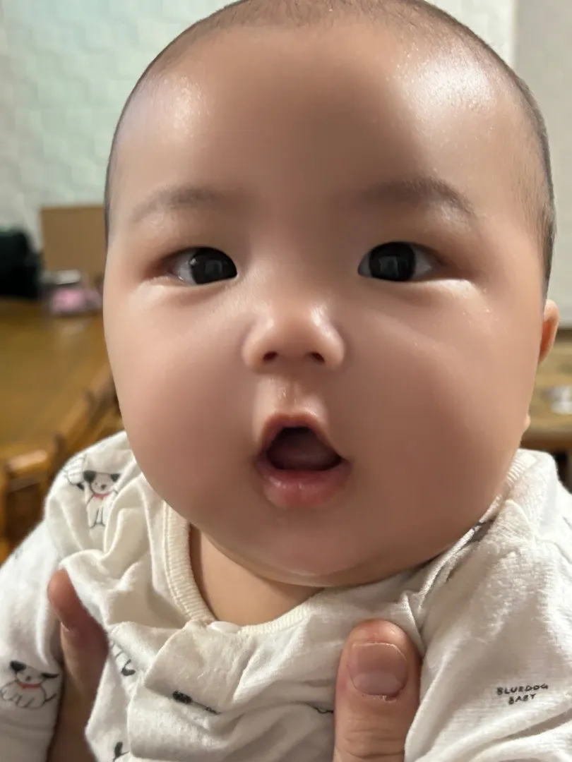 첫몸무게 4.3(정상) 156일차 10.1kg 이거 맞나요.