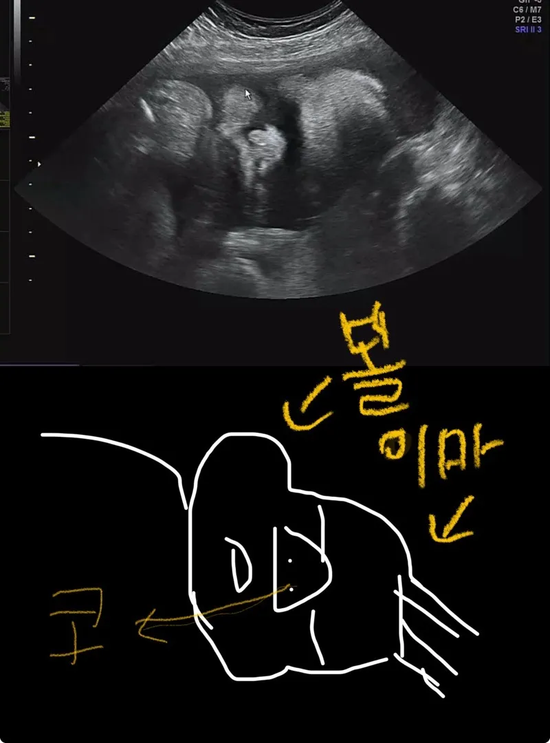 33주 초음파 아기 얼굴 원래 이런가요 ㅎㅎ