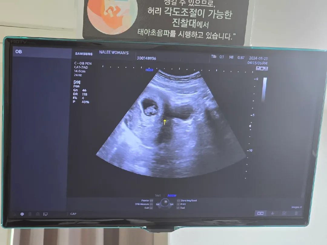 7주6일