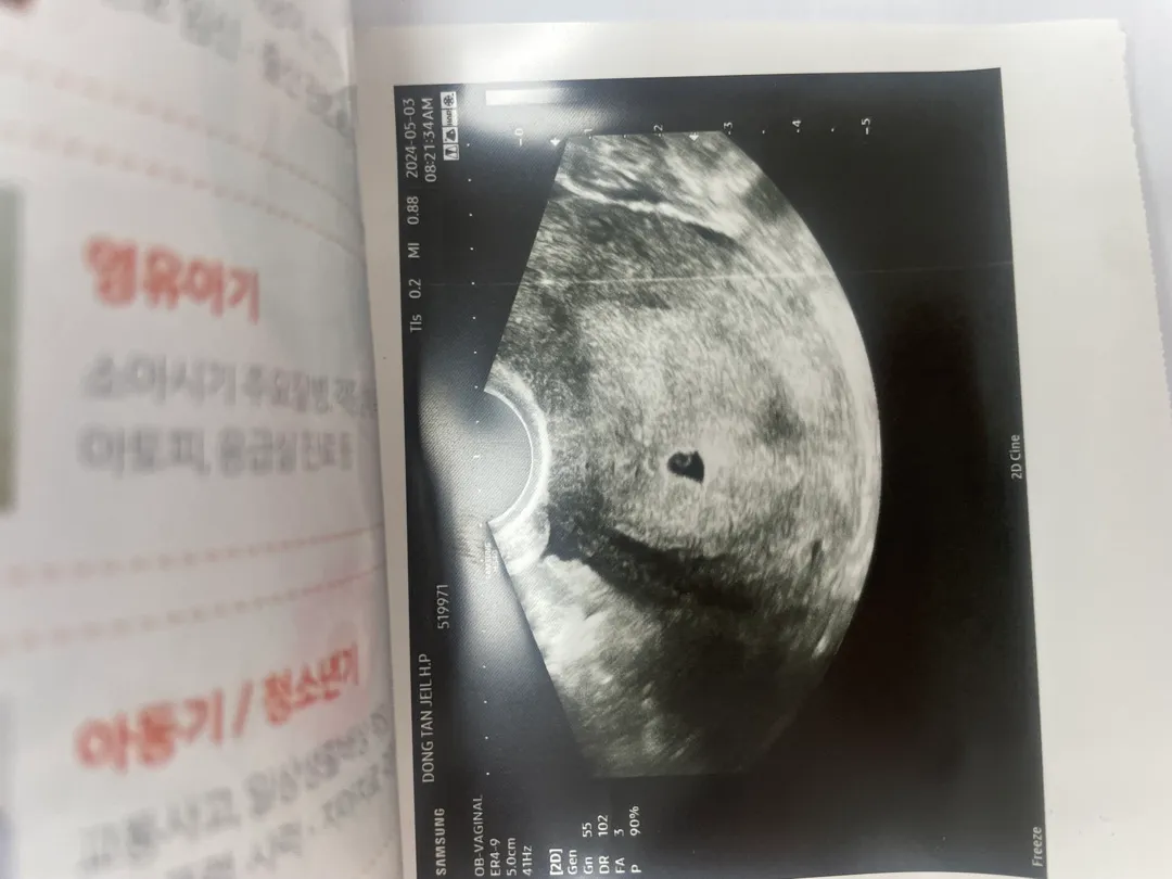 심장소리를 너무나도 기다려요