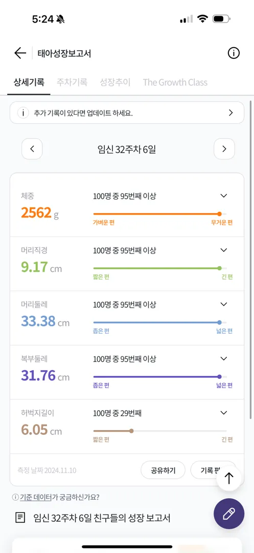 32주차에 2.5키로 머리크기 9cm … 자분vs 제왕