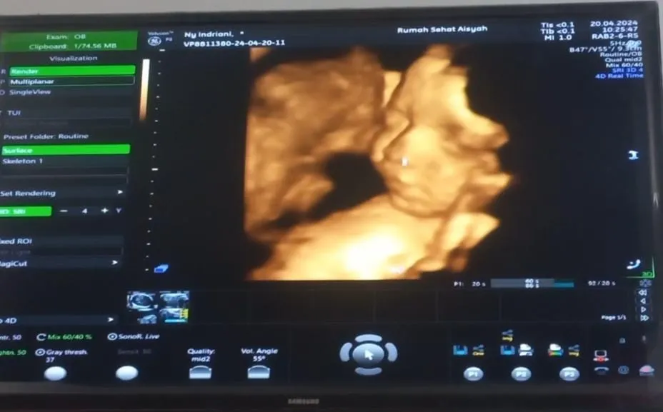 Cara mengetahui wajah bayi nya 