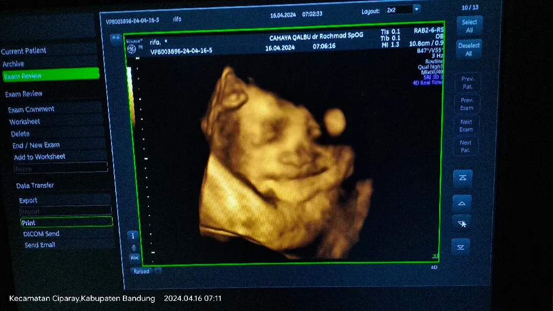 Event prediksi wajah bayi 