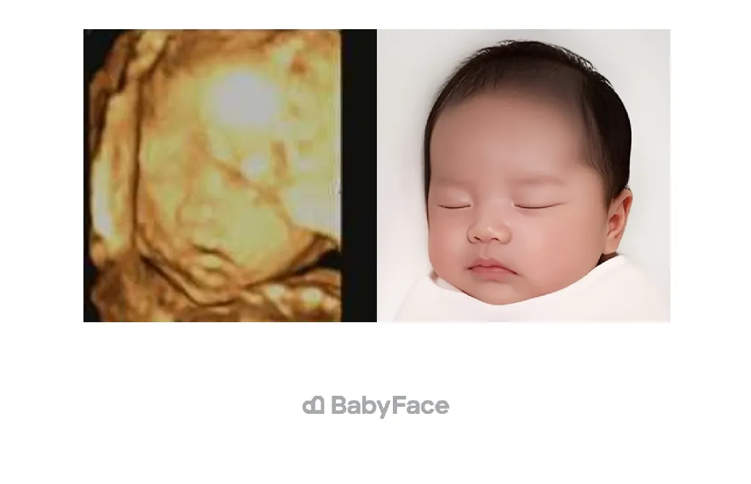 입초 후, 베이비페이스했어요