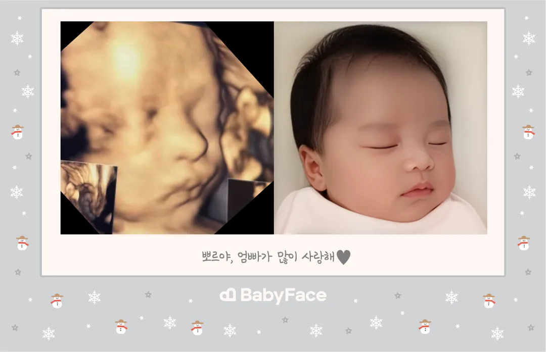 입체초음파하자마자 베이비페이스 ㅋㅋ