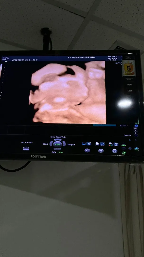 Bismillah semoga cintaku sehat selalu❤️ si cantik si sholehah mima #AIBilly