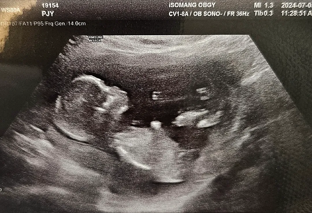 13주5일차 각도법 알려주세요👶🏻❤