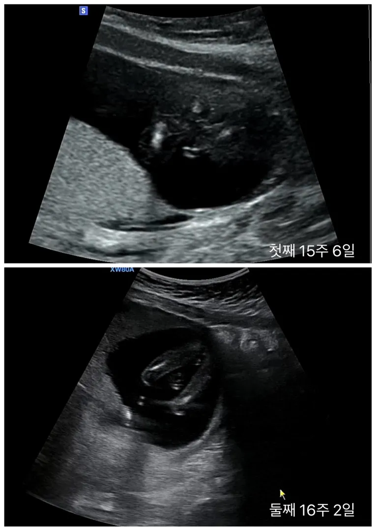 첫째와 둘째!😆