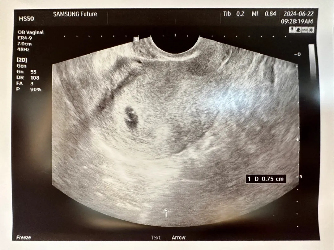 아기집 보고 왔어요 >_<