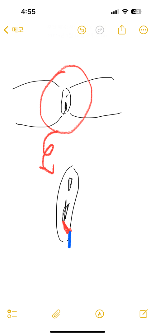 회음부가 많이 찢어졌는데 이거 정상인가요..?