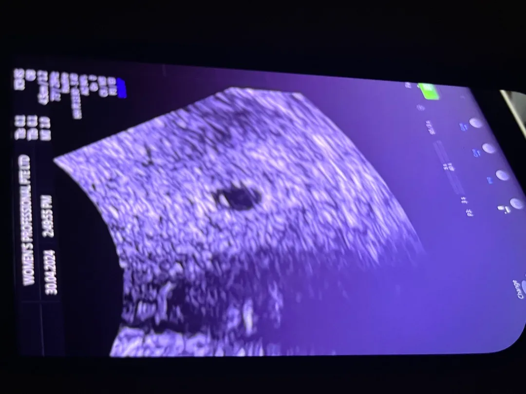이거 난황 맞나요? 