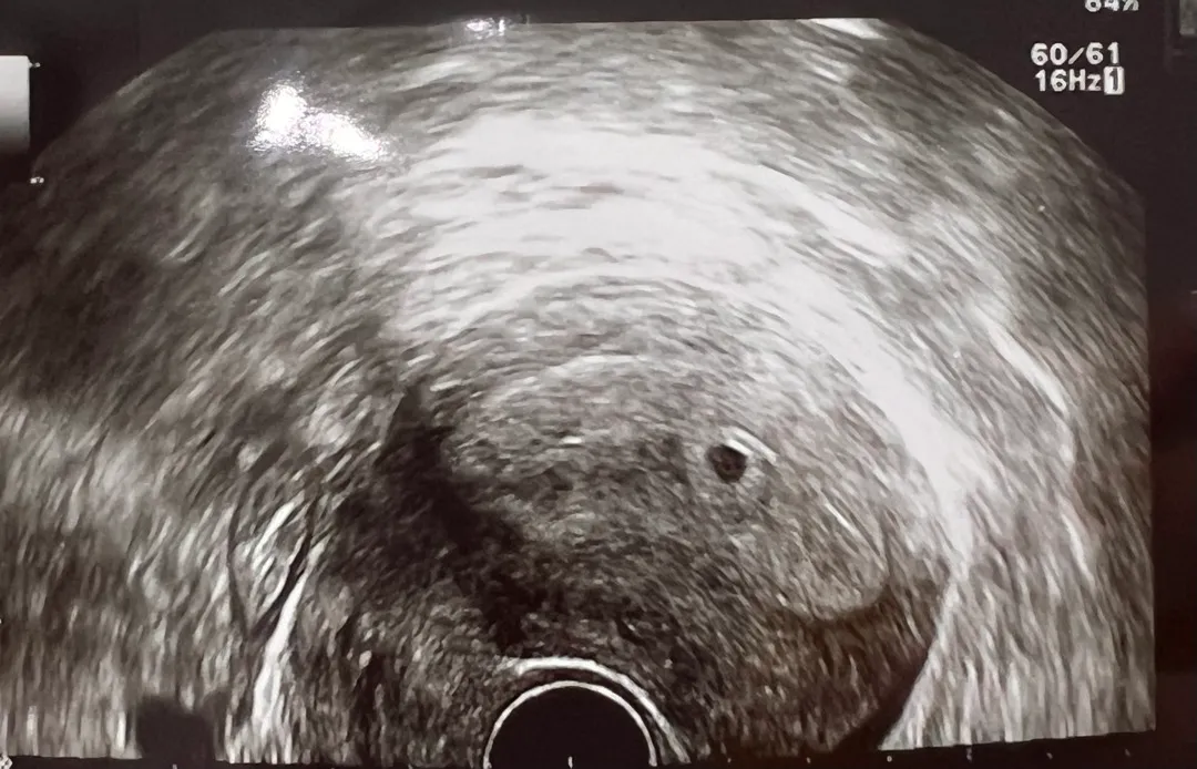 5W3D 아기집 봤어요!