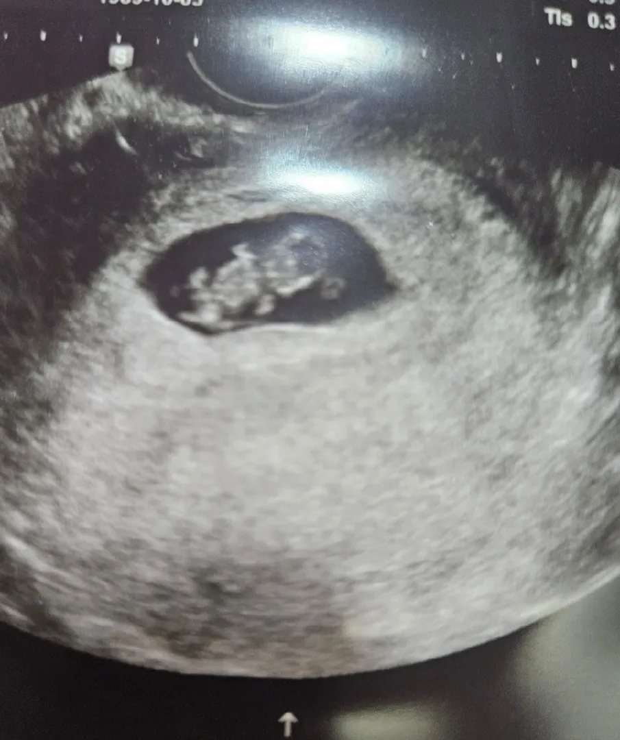 8주2일