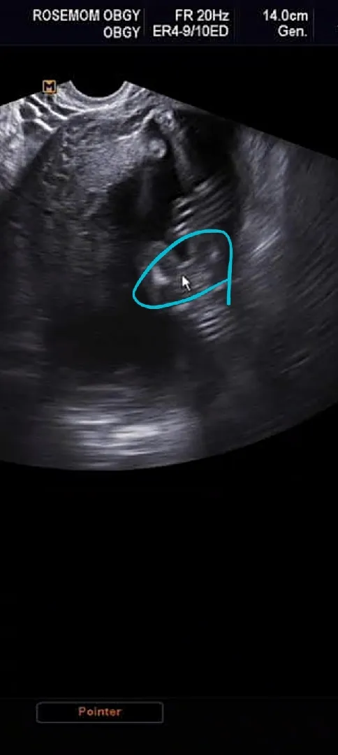 딸 맞을까요?