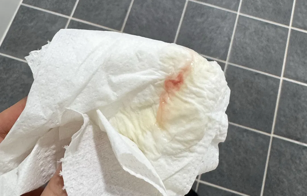 막달검사 균검사 후 자꾸 피가 비춰요ㅜ