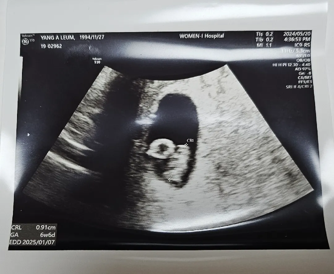6w6d 엄청 작은 젤리곰 봤어용!