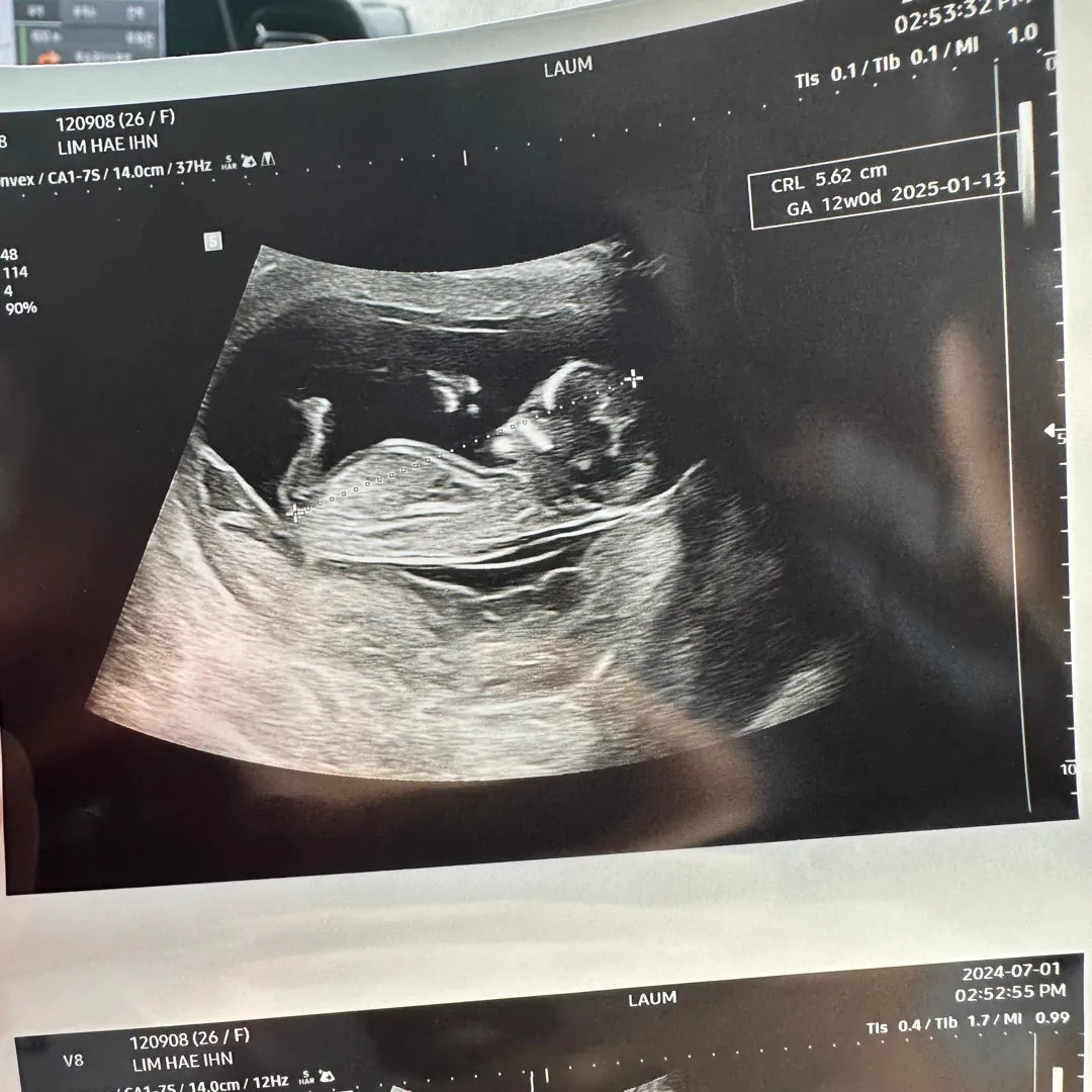 11주 6일❤️