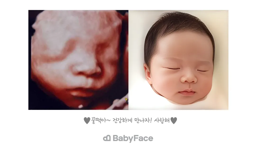 아기초음파! 코가 큰편인가요? 궁금!