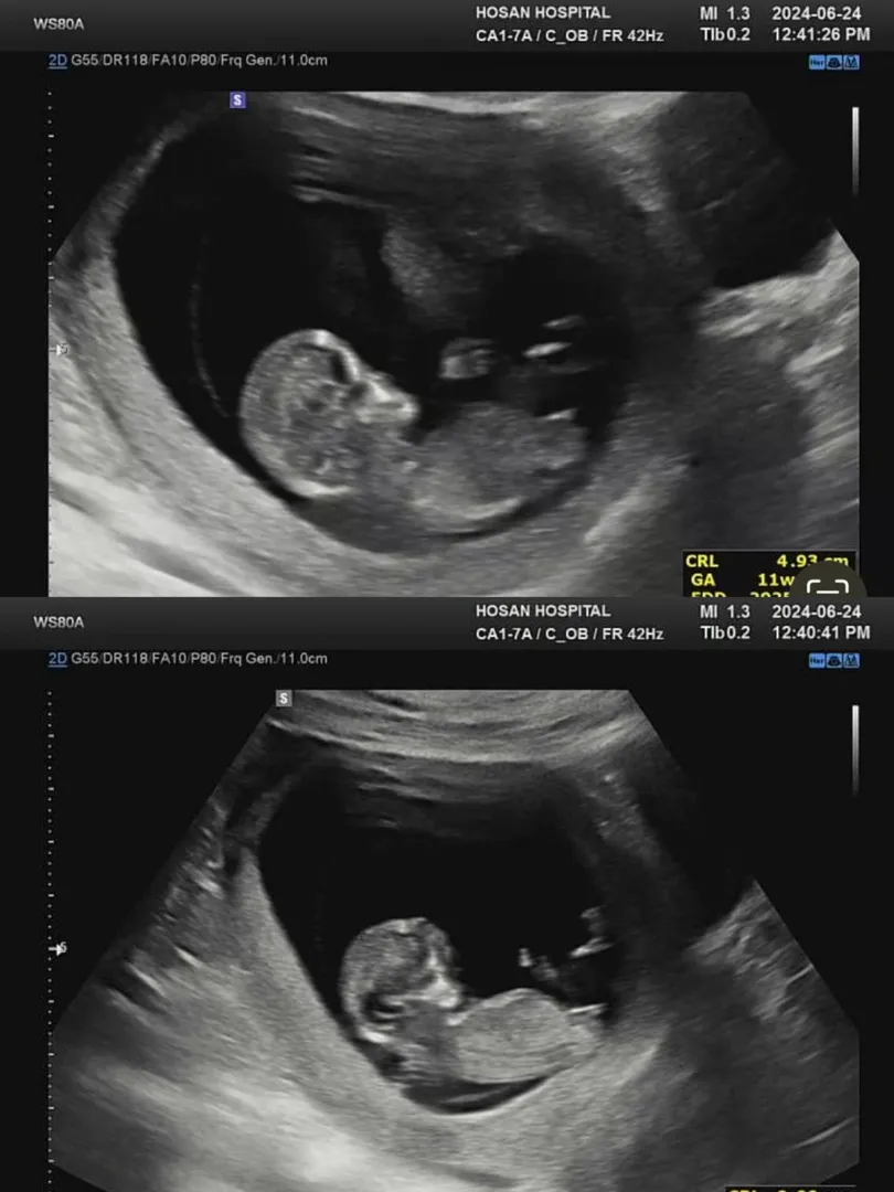 각도법 봐주세요! 👶🏻