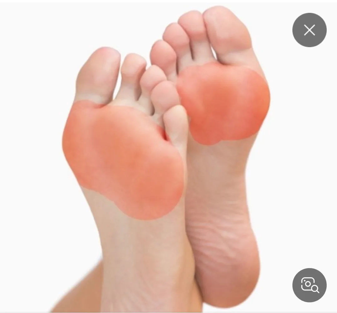 막달 손발 통증