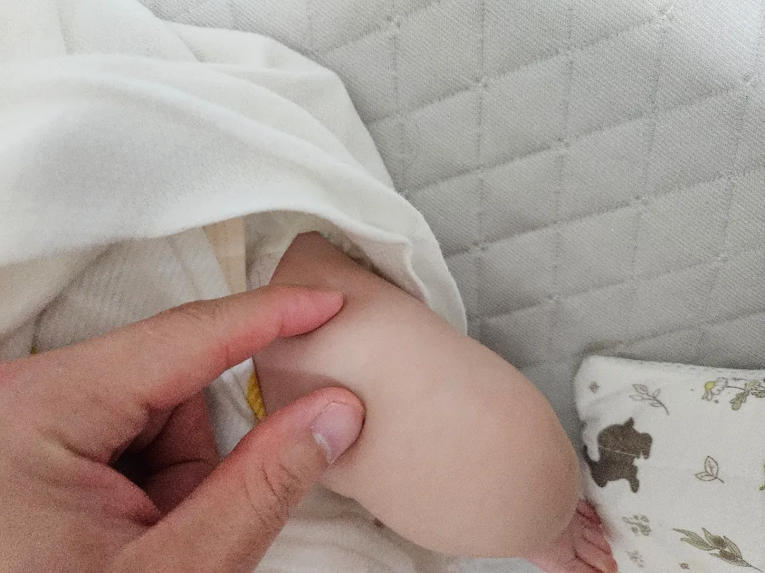 생후 71일 아기 윗벅지 딱딱함? 아시는분 계실까요?
