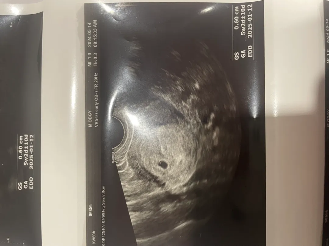 6주 2일차인데 증상이 없어요