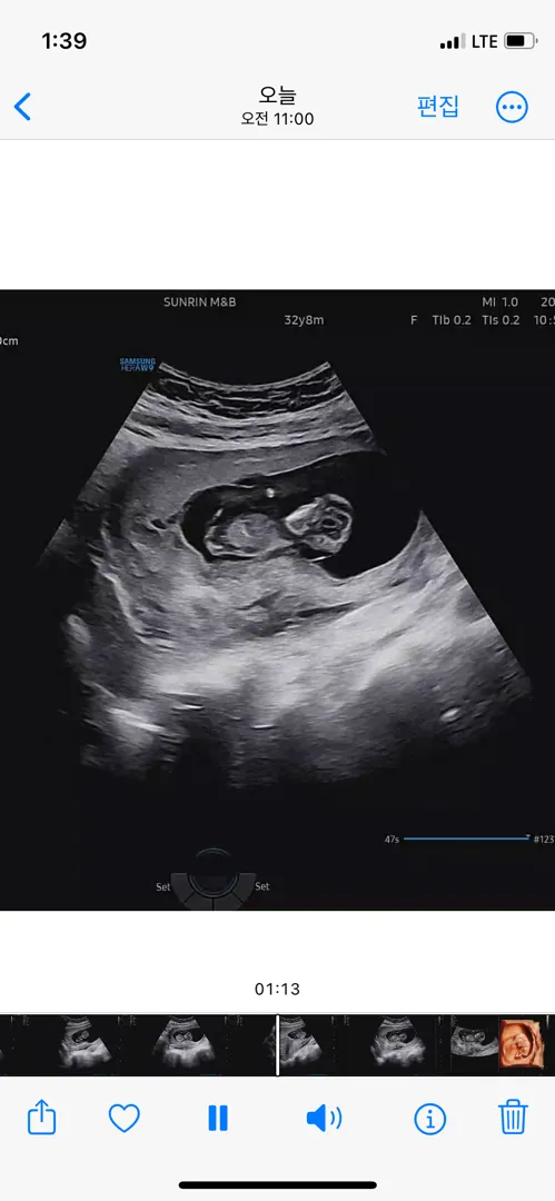 11주5일 각도법