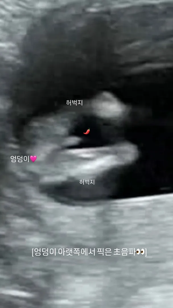 성별반전!!! 아들맘 99% 네용ㅋㅋㅋ