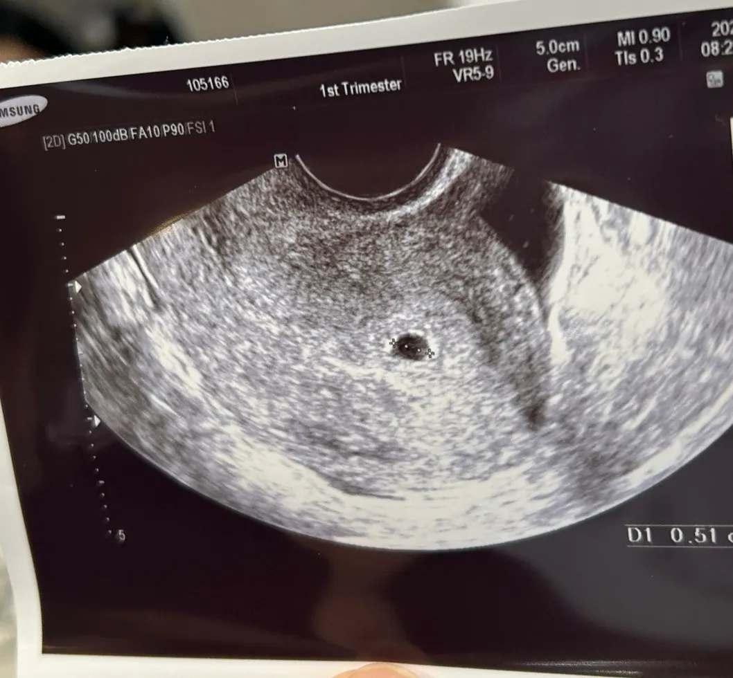 막생 4월21일인데 아기집 보고왔어요
