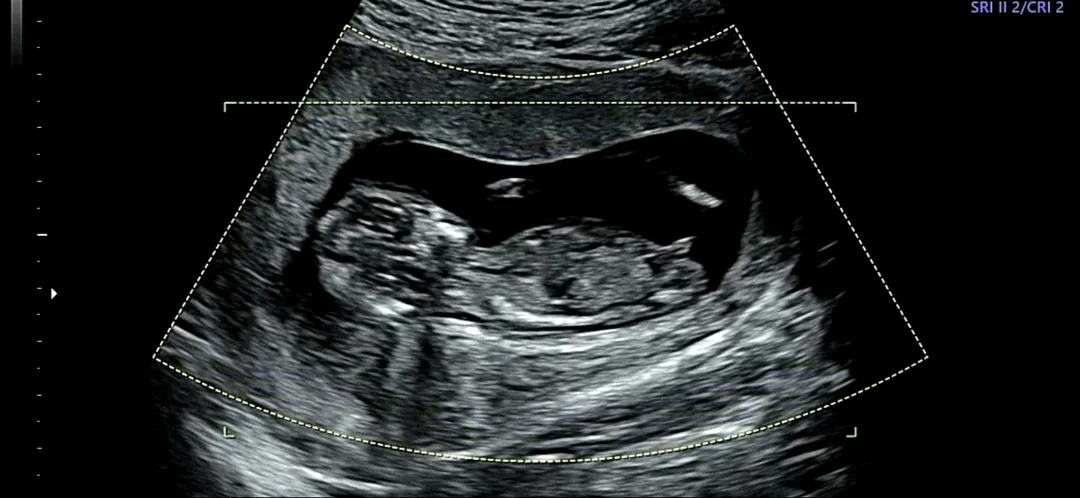 12주 성별