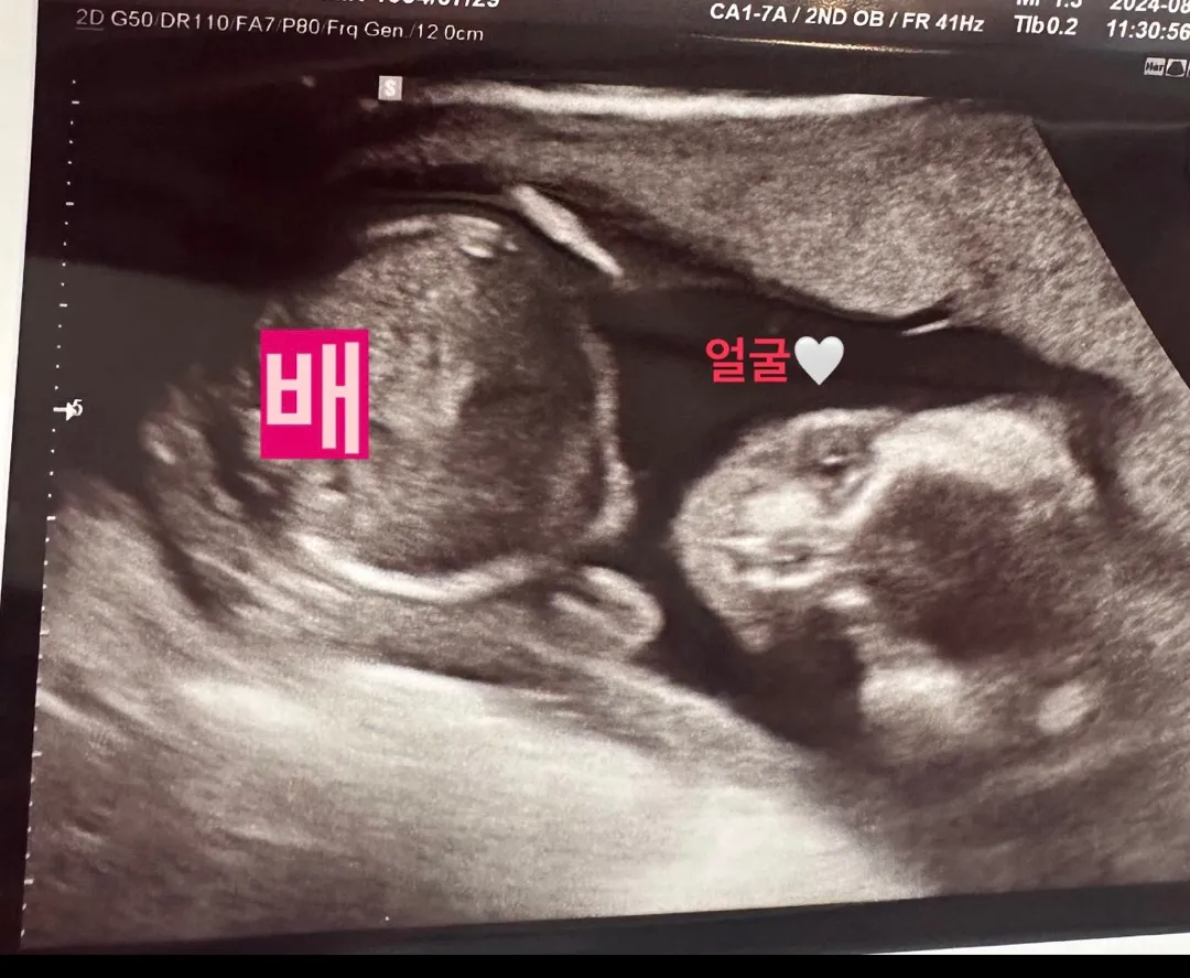 정면얼굴은 처음 봤어요!! 🥹❤️
